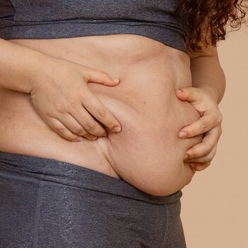 Vertical photo of barefoot fat extra weight woman double chin, looking on dangling belly.